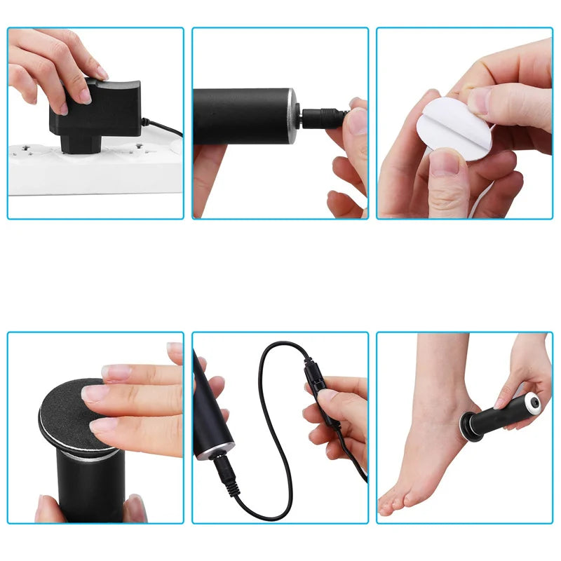 Foot Callus Remover